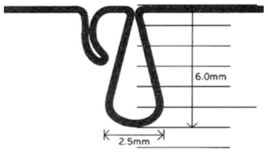 Device and method for assisting invisible orthodontic treatment of mesial mobile molars