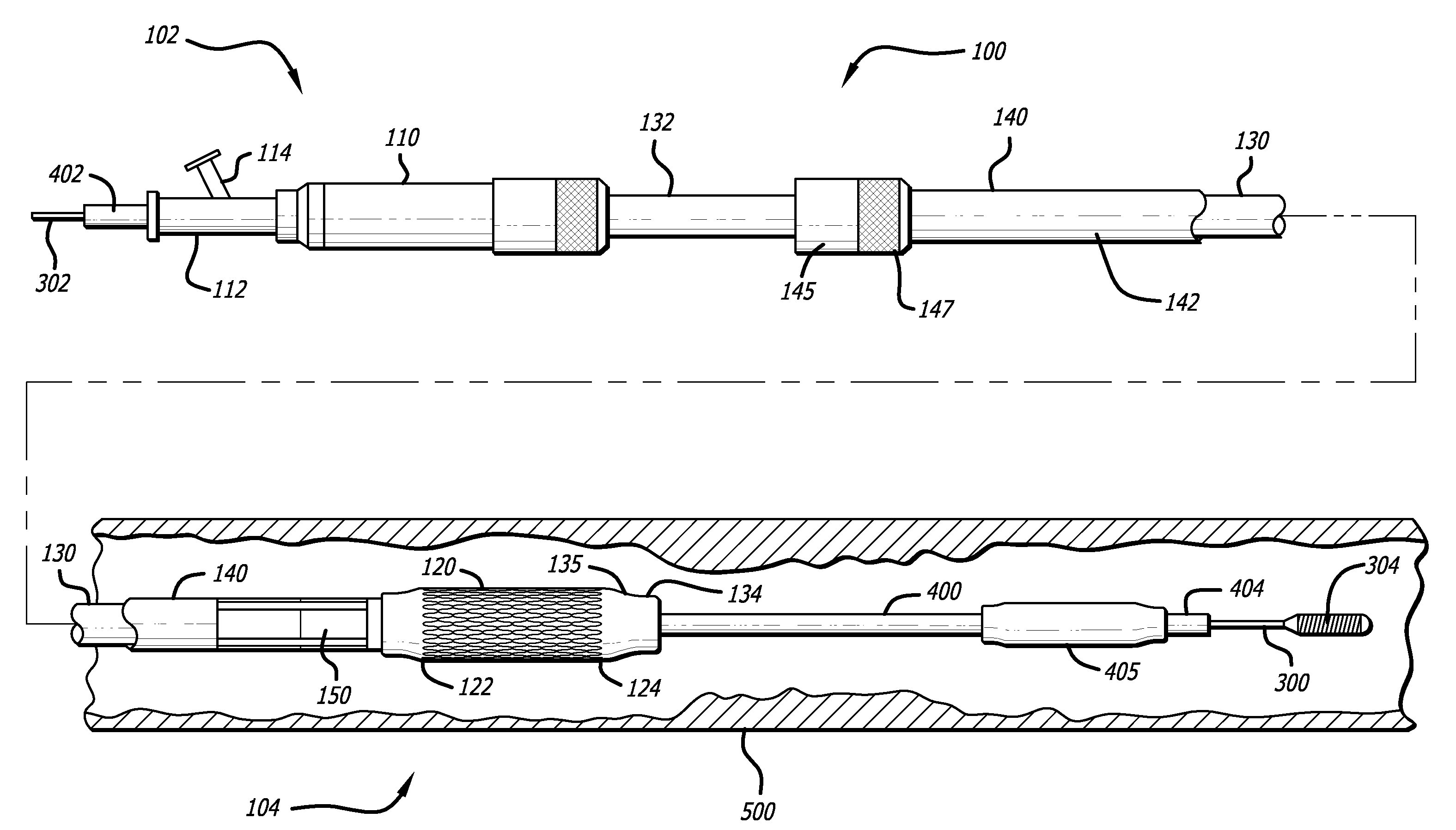 Ostial lesion stent delivery system