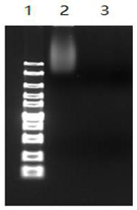 Method for extracting trace agkistrodon halys venom genes, specific detection method and kit