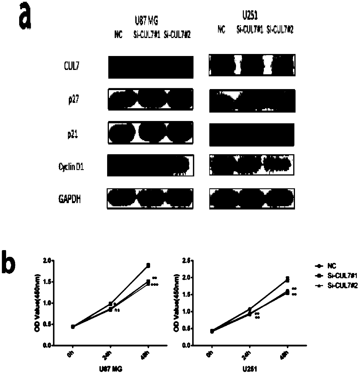 Application of CUL7 in glioma diagnosis, treatment and prognosis