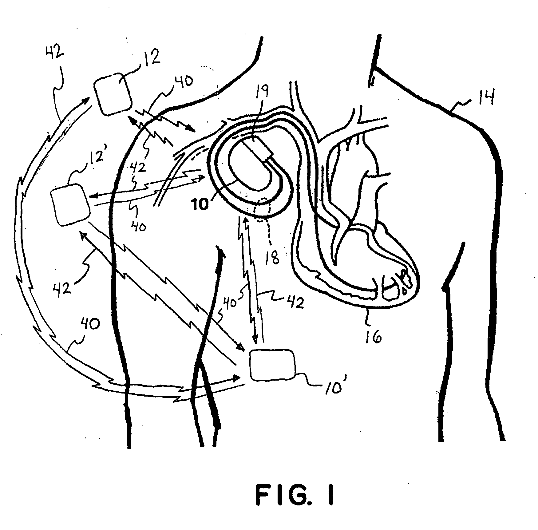 Protocol implementation for telemetry communications involving implantable medical devices