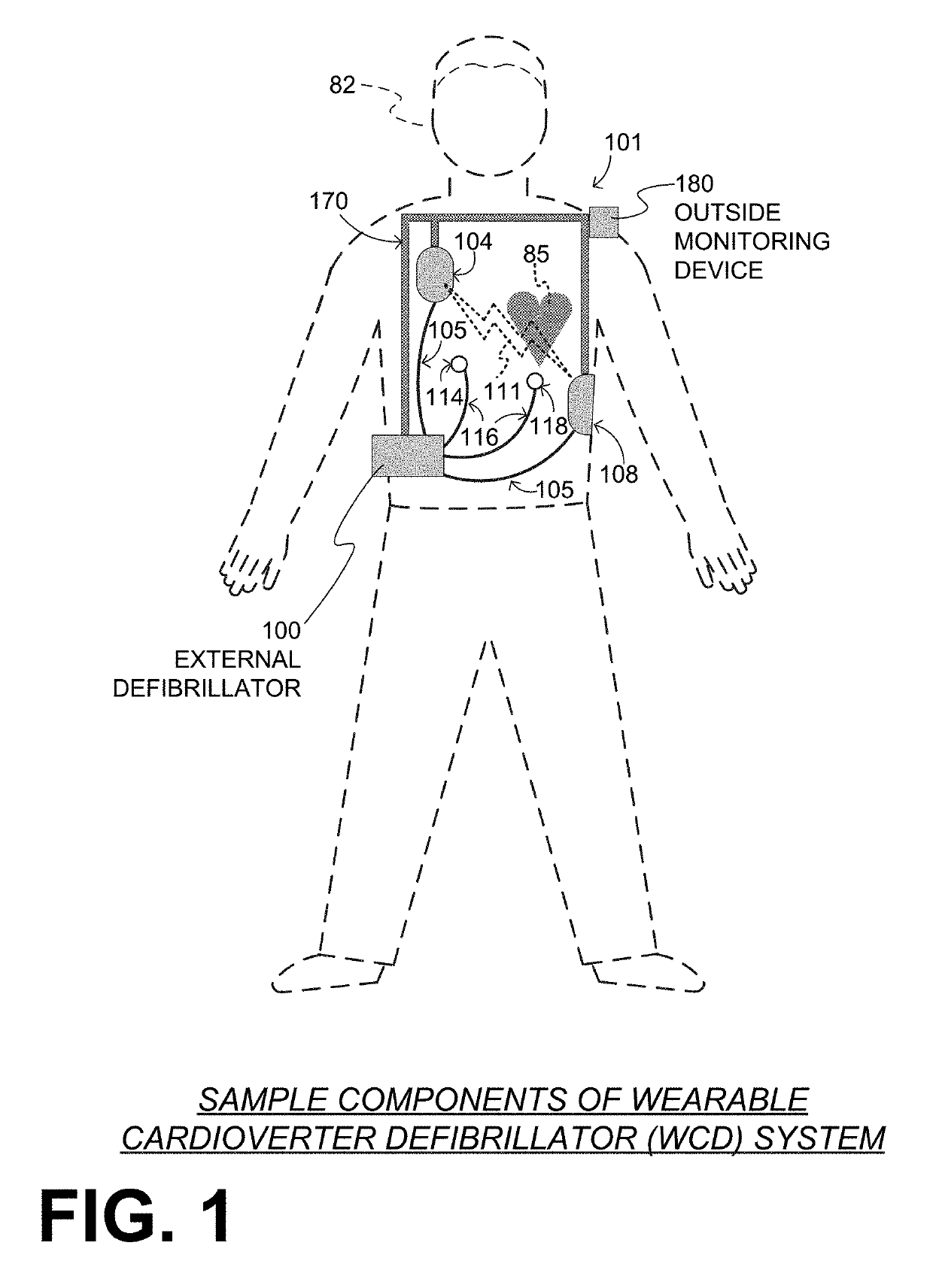 Wearable cardioverter defibrillator (WCD) system with isolated patient parameter component