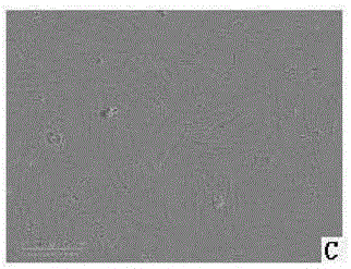 Separate culture method for human amniotic mesenchymal stem cells