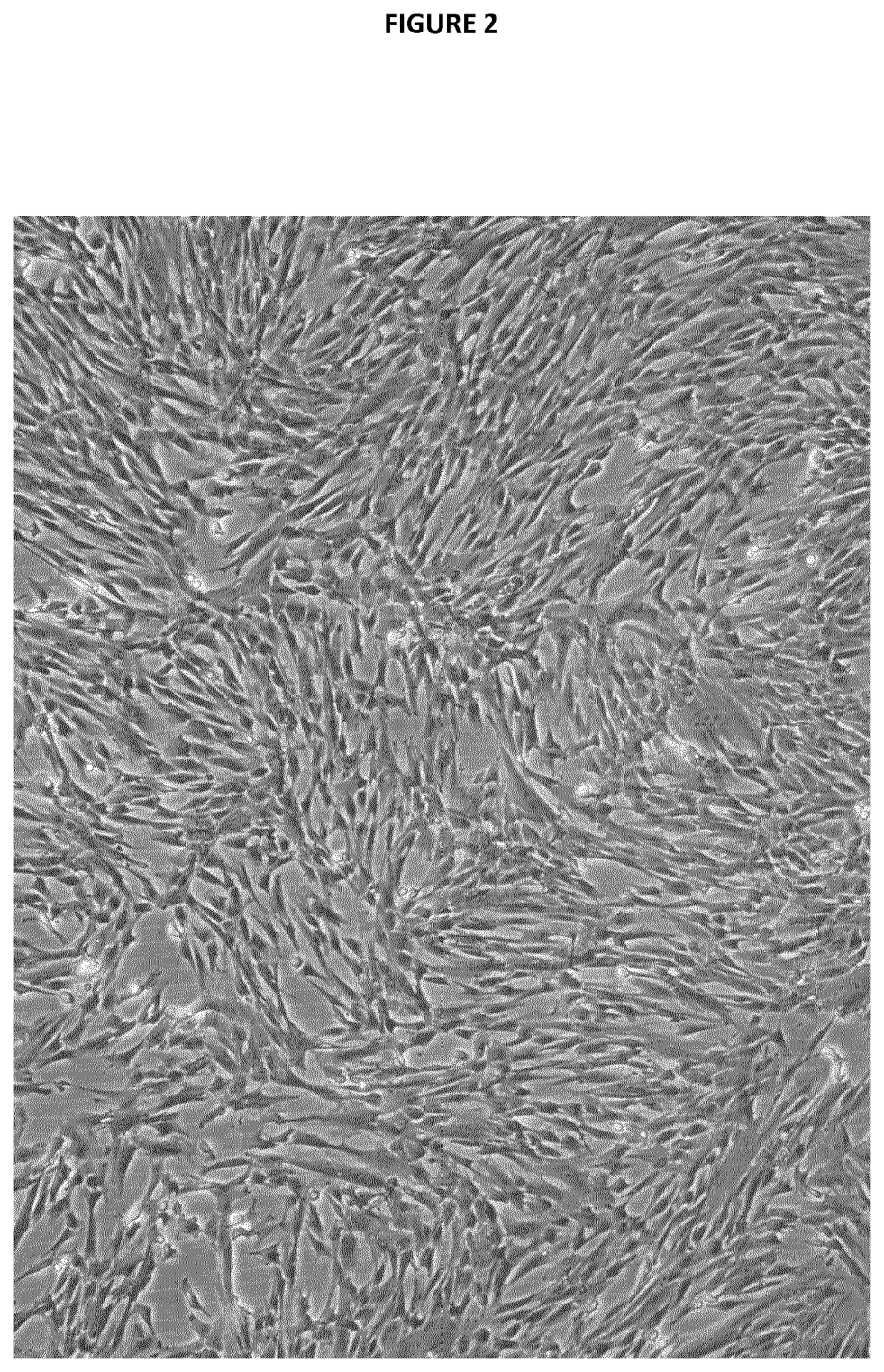 Perinatal tissue derived mesenchymal stem cells: method of preparation and uses thereof