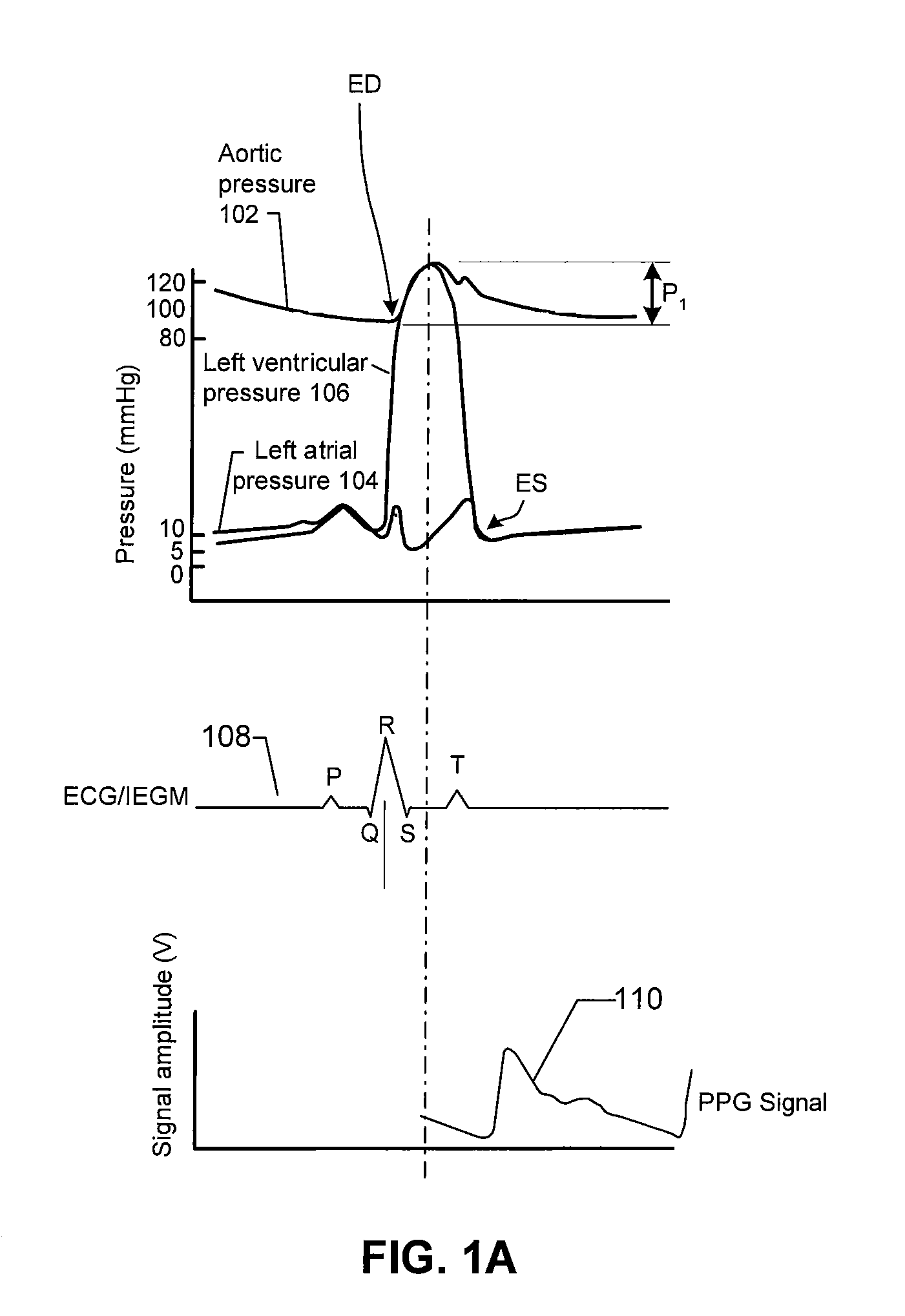 Implantable hemodynamic monitor and methods for use therewith