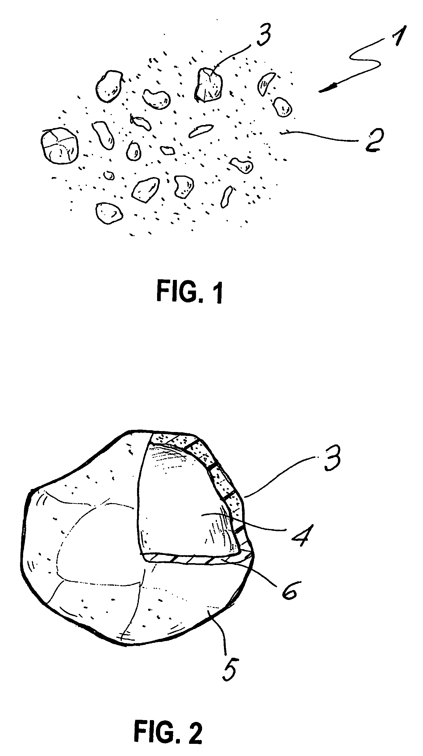 Bone cement containing coated radiopaque particles and its preparation