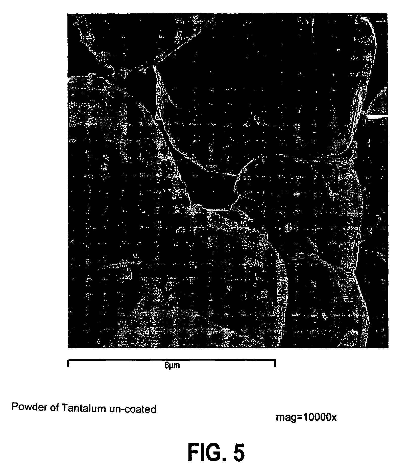 Bone cement containing coated radiopaque particles and its preparation
