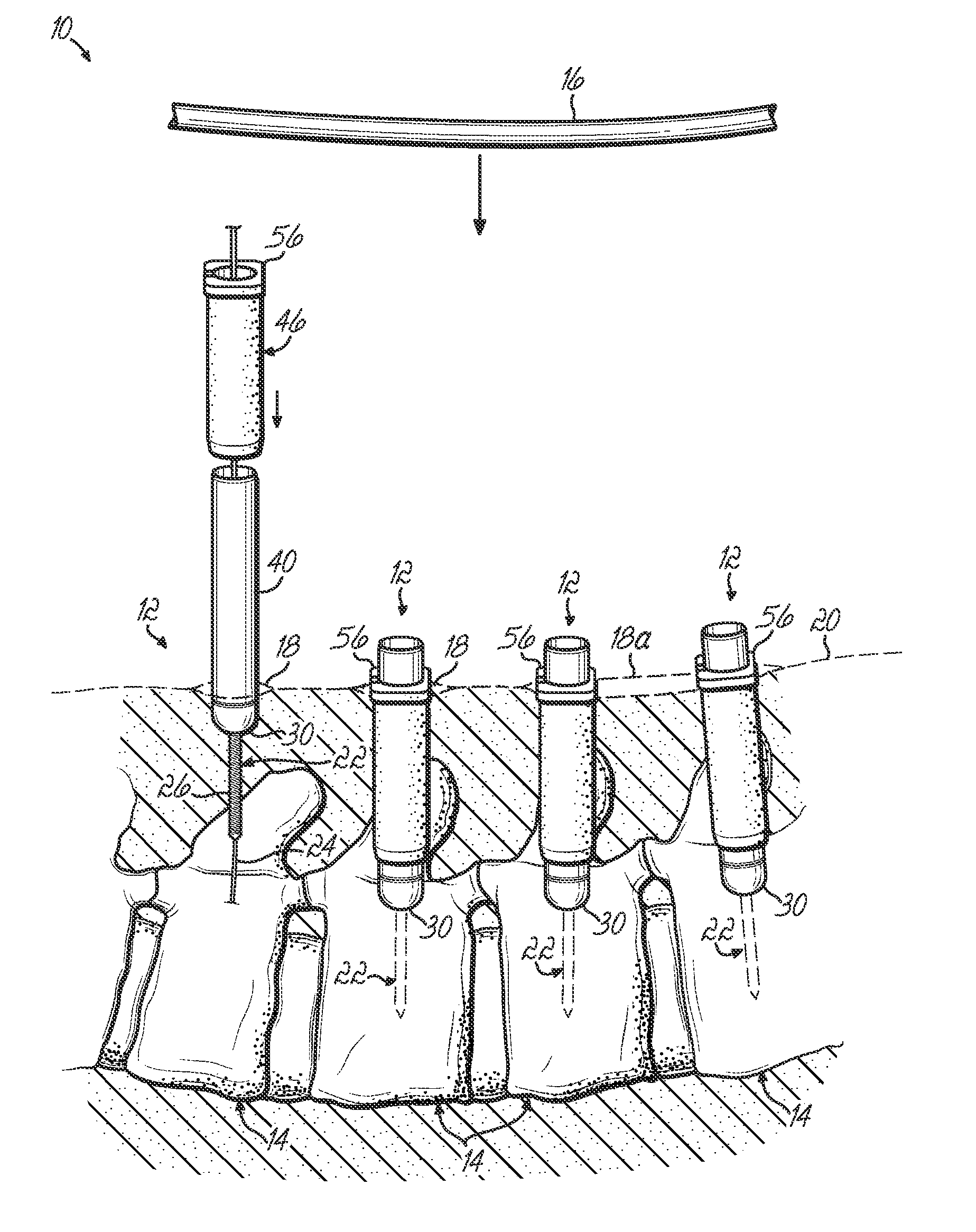 Minimally invasive pedicle screw access system and associated method