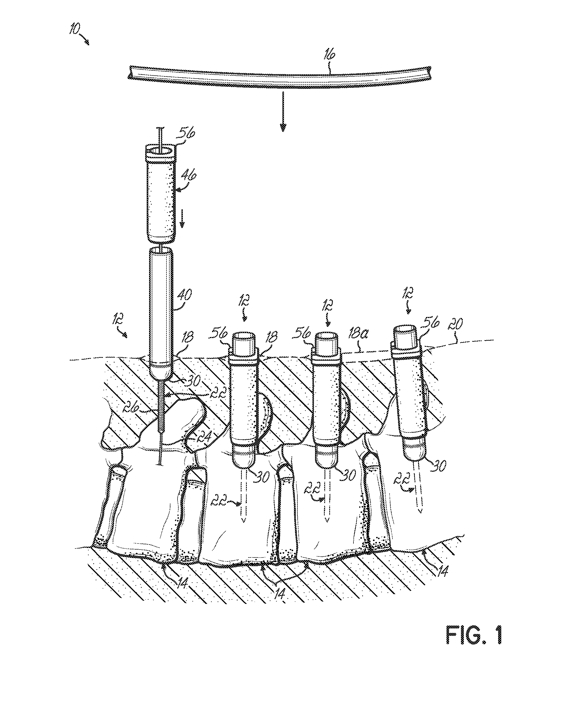 Minimally invasive pedicle screw access system and associated method
