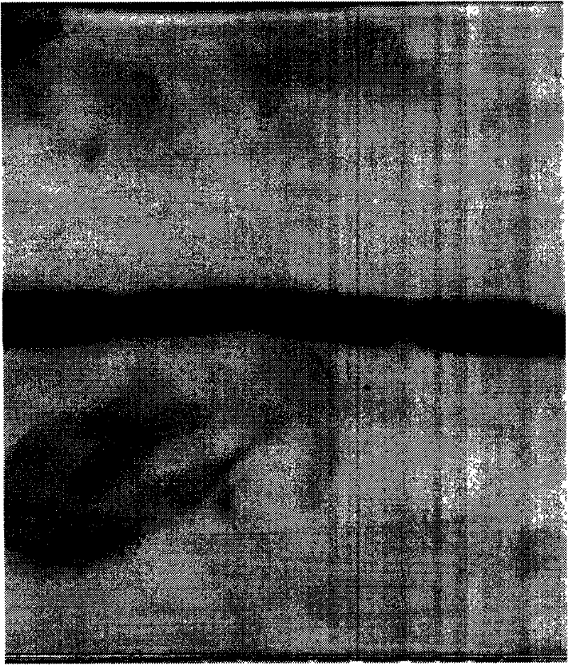 Renaturation and purification process of recombinant human granulocyte colony-stimulating factor