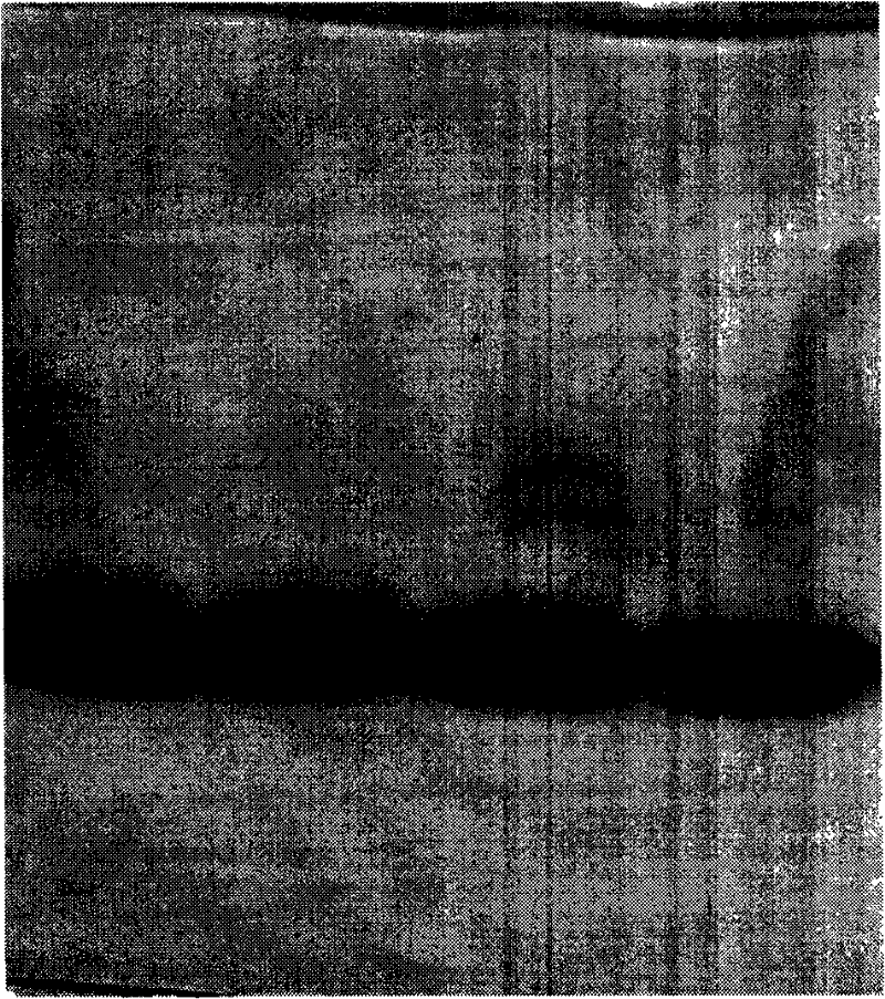 Renaturation and purification process of recombinant human granulocyte colony-stimulating factor