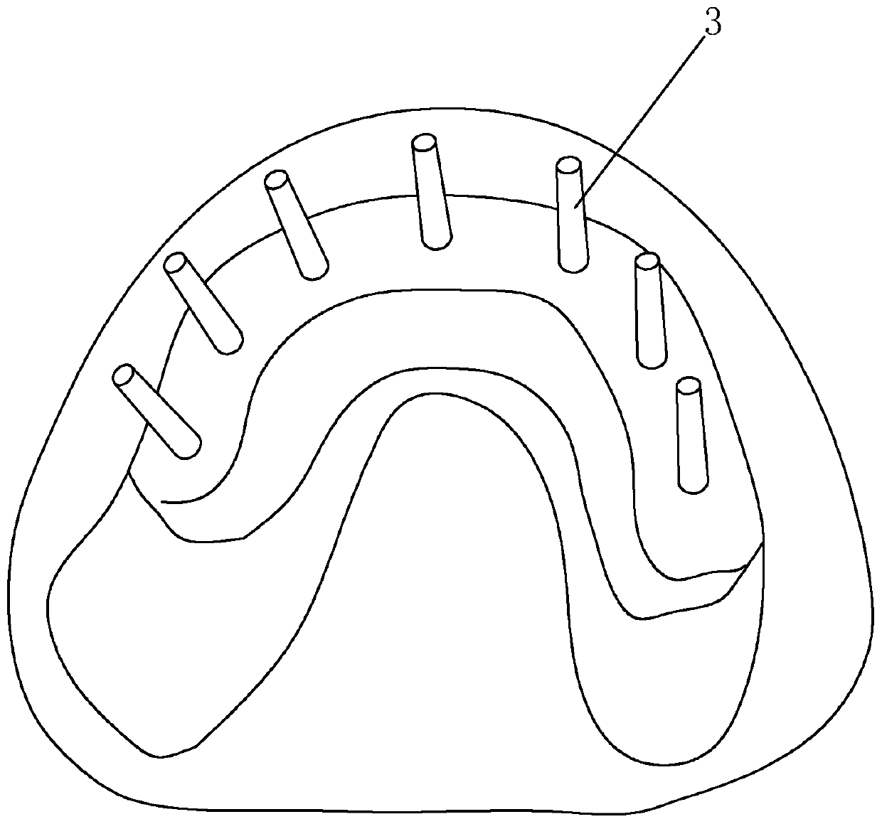 Making method of edentulous jaw precise tooth transfer model