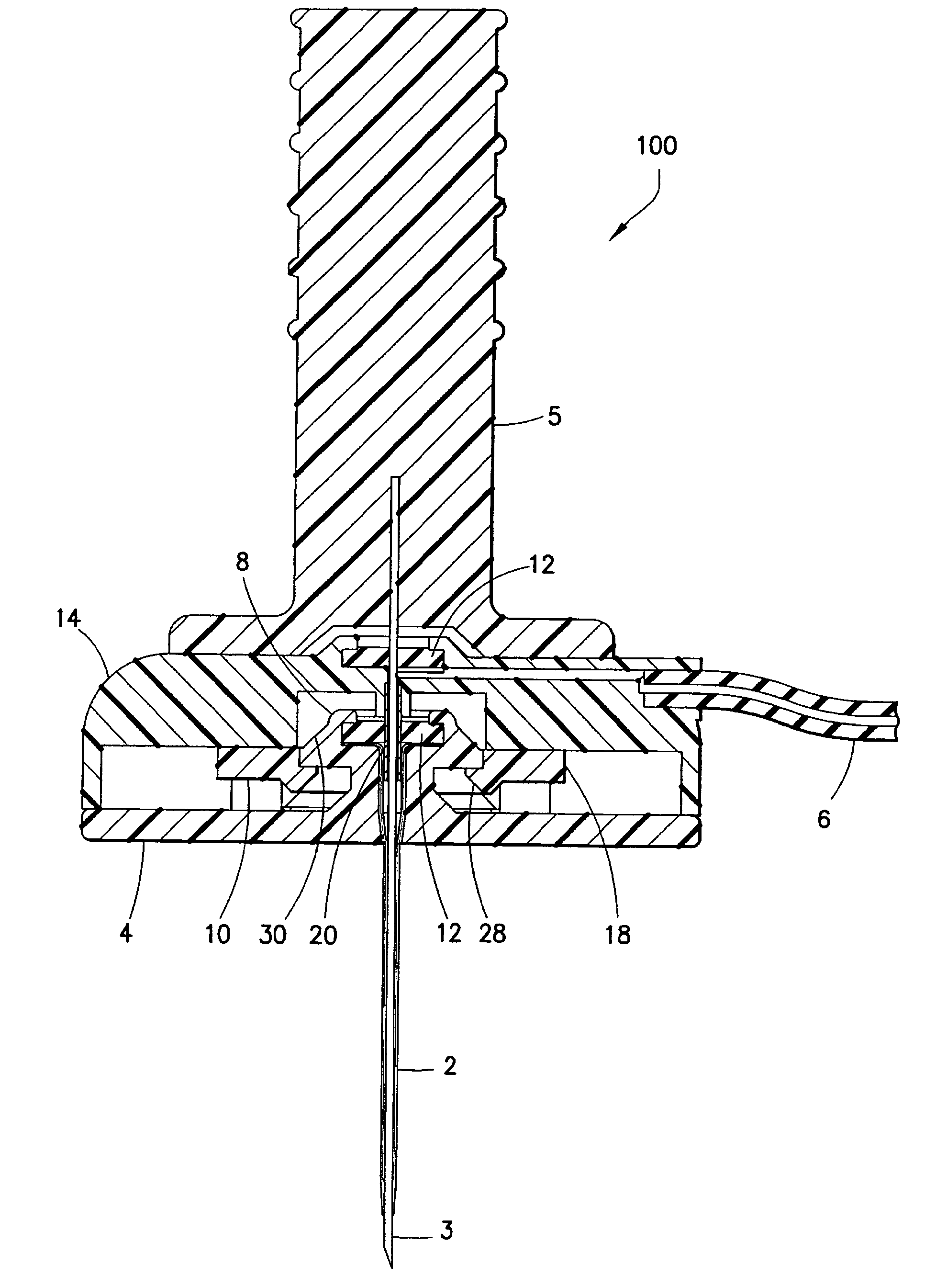 Separatable infusion set with cleanable interface and straight line attachment