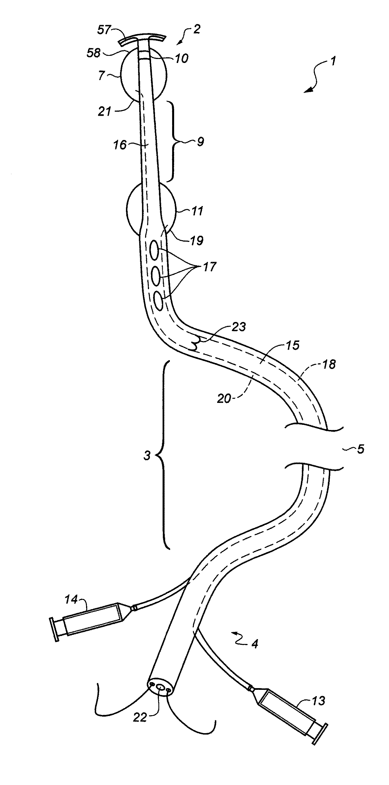 Endovascular catheter with multiple capabilities