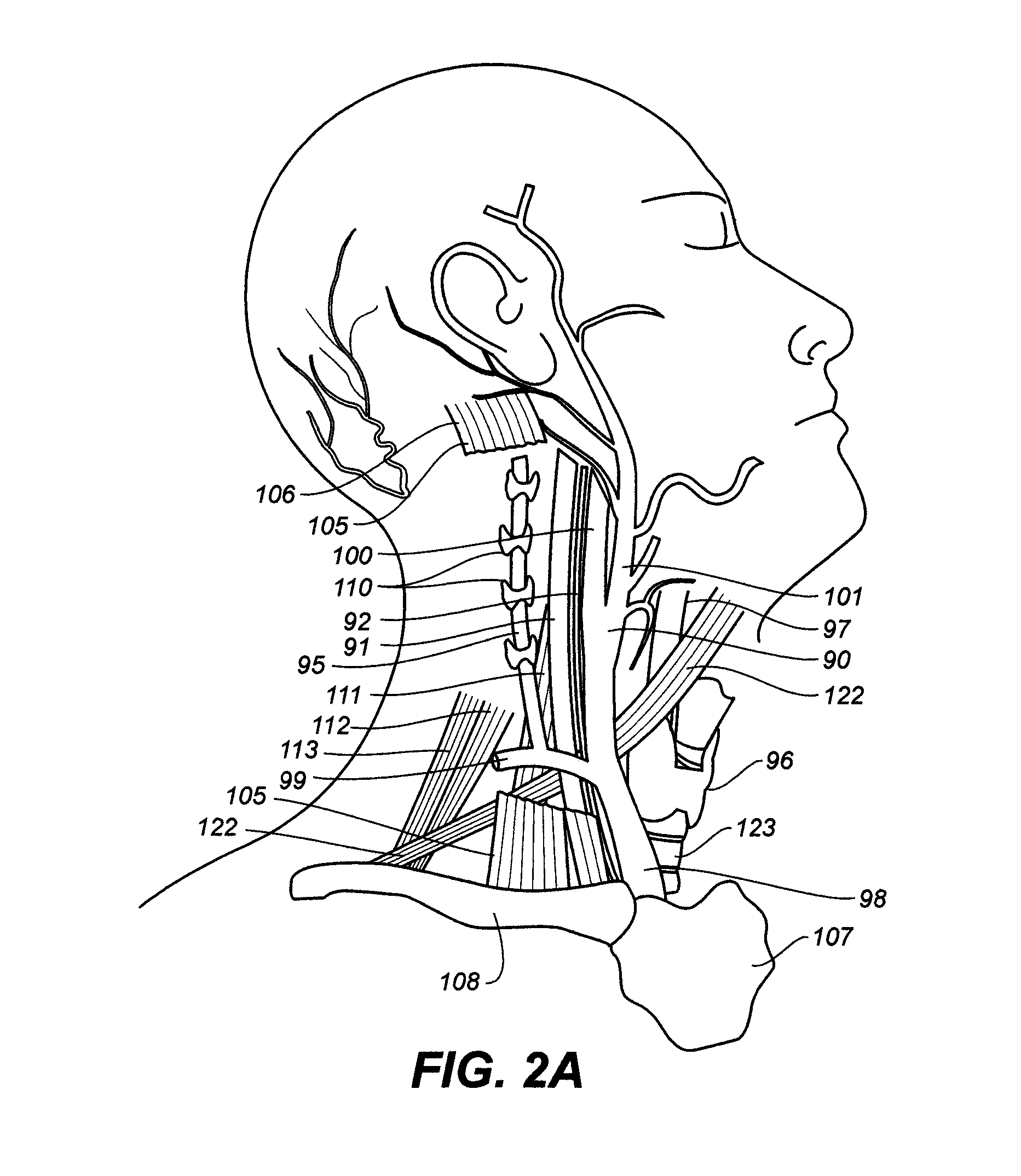 Endovascular catheter with multiple capabilities