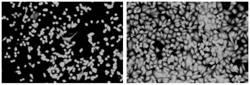 Multifunctional stent coating based on recombinant human collagen and preparation method of multifunctional stent coating