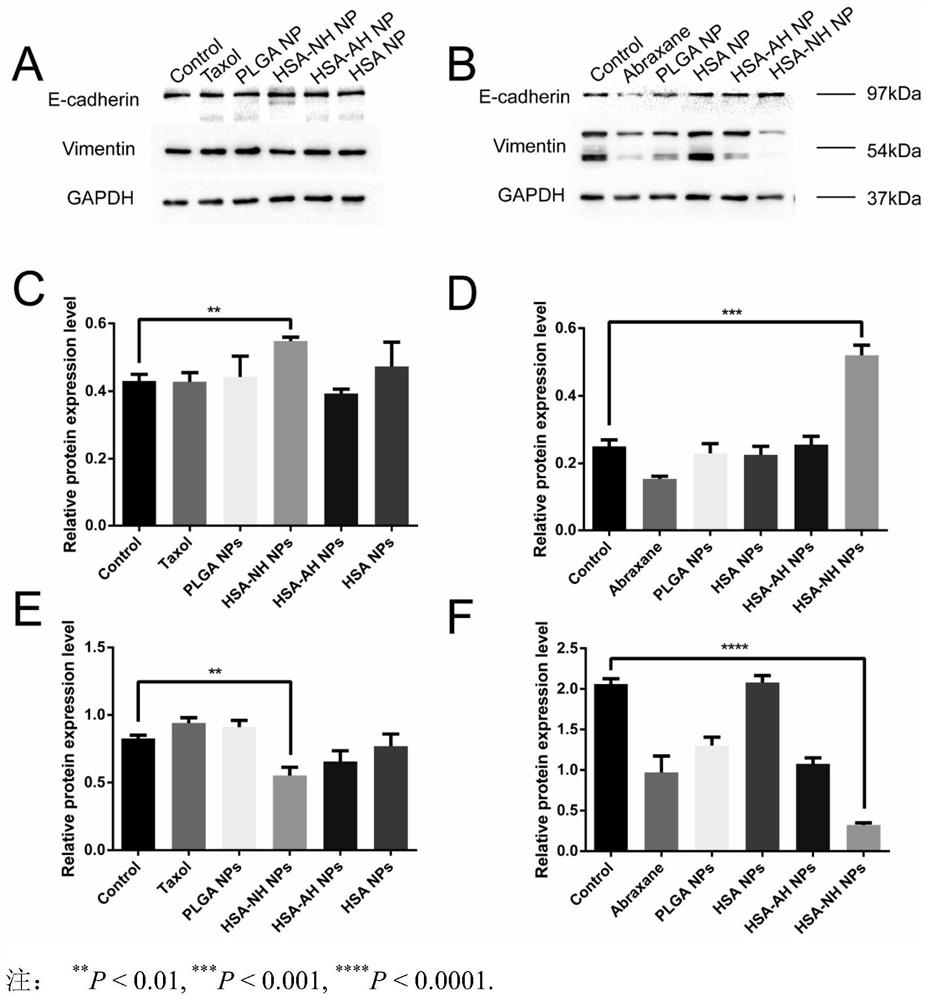 Albumin nano drug delivery system with anti-tumor metastasis and targeting functions and preparation method of albumin nano drug delivery system