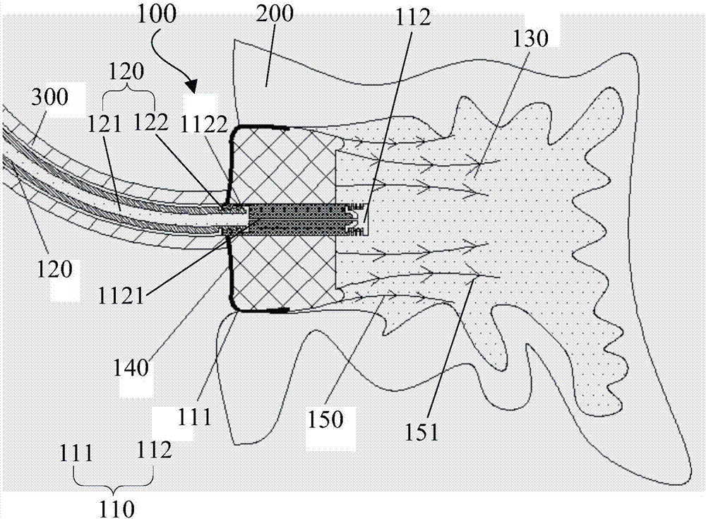 Left atrial appendage occlusion device