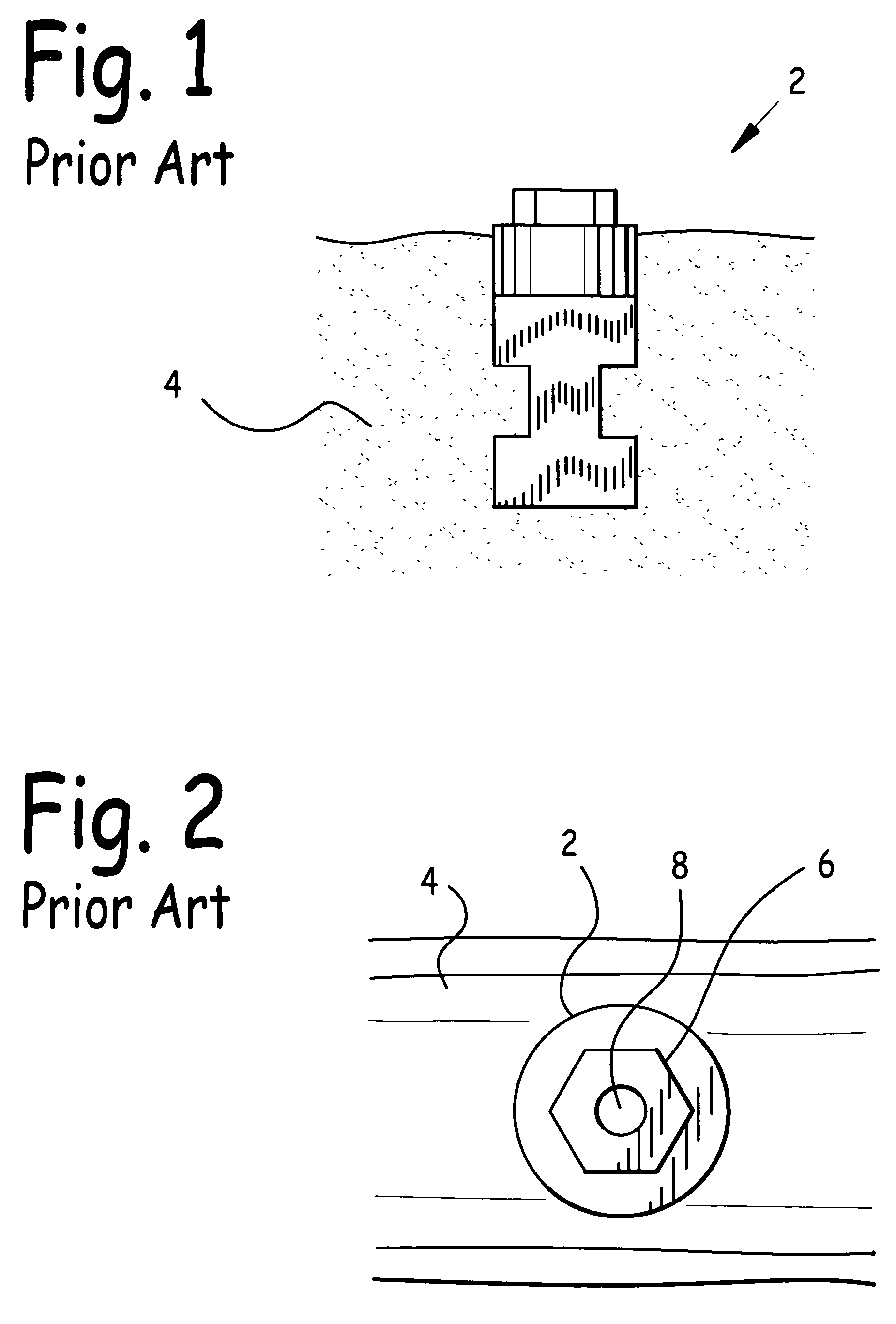 Apparatus and method to remove dental implant