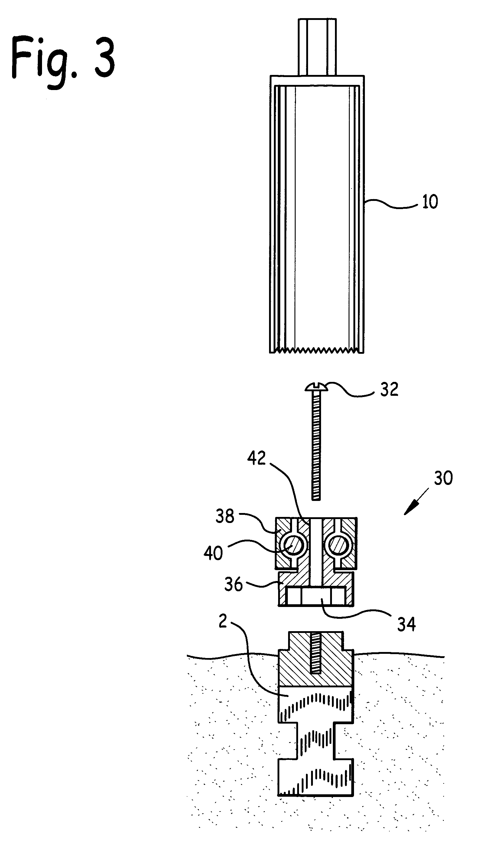 Apparatus and method to remove dental implant