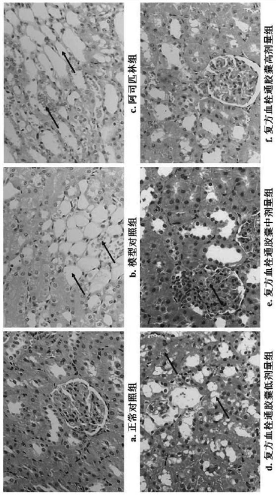 Application of Compound Xueshuantong Preparation in Preparation of Drugs for Treating Kidney Damage Caused by Hypertension