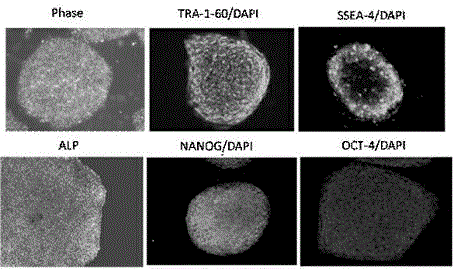 Serum-free medium of embryonic stem cells, and its application