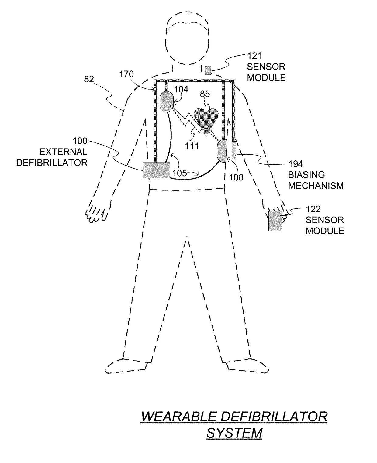 Wearable cardiac defibrillator system long-term monitoring alternating patient parameters other than ECG