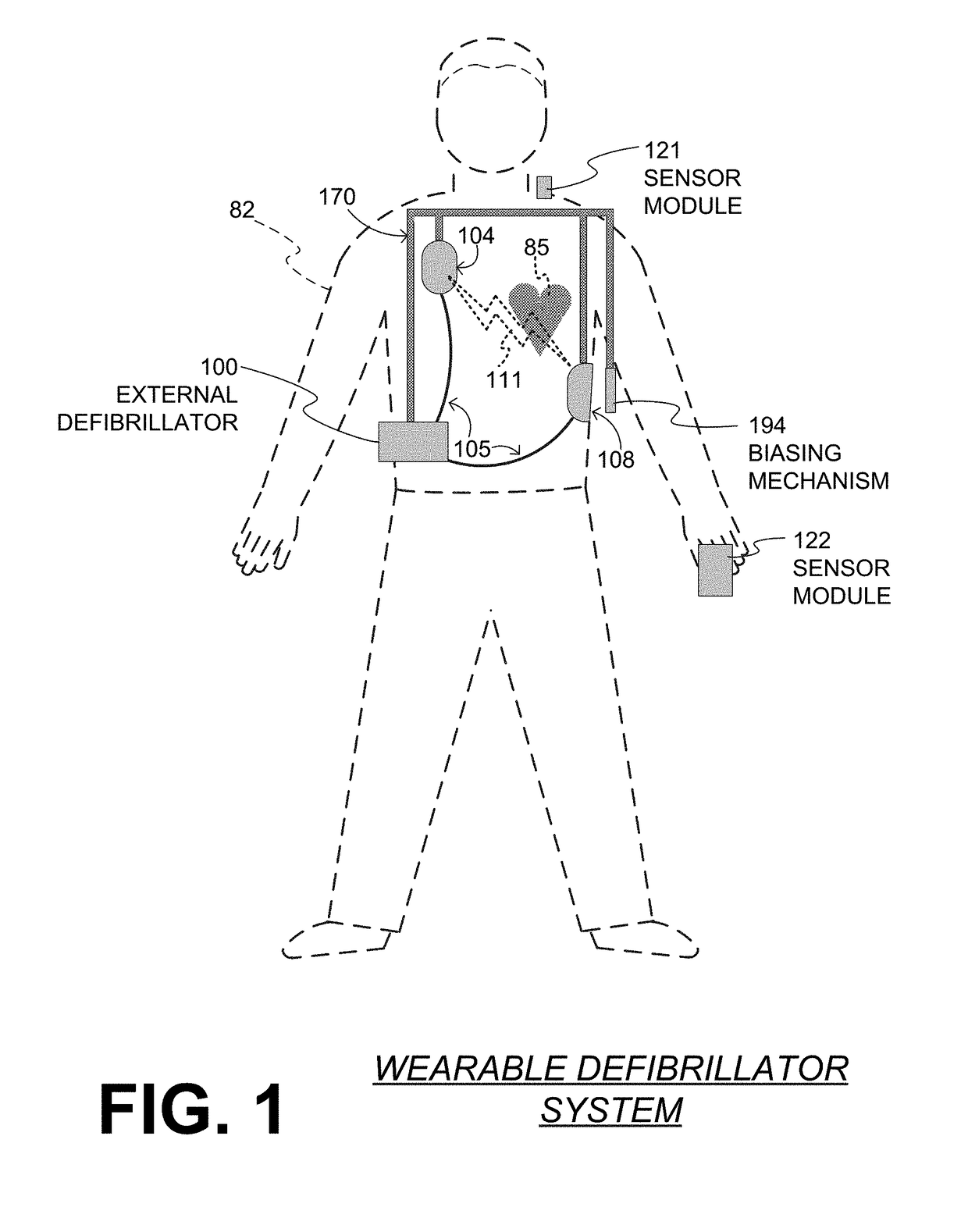 Wearable cardiac defibrillator system long-term monitoring alternating patient parameters other than ECG