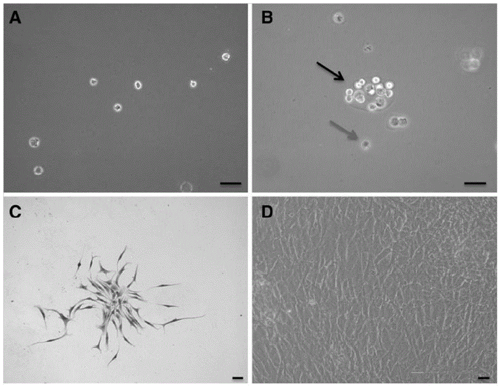 Preparation method and application of immortalized human cartilage endplate stem cell line