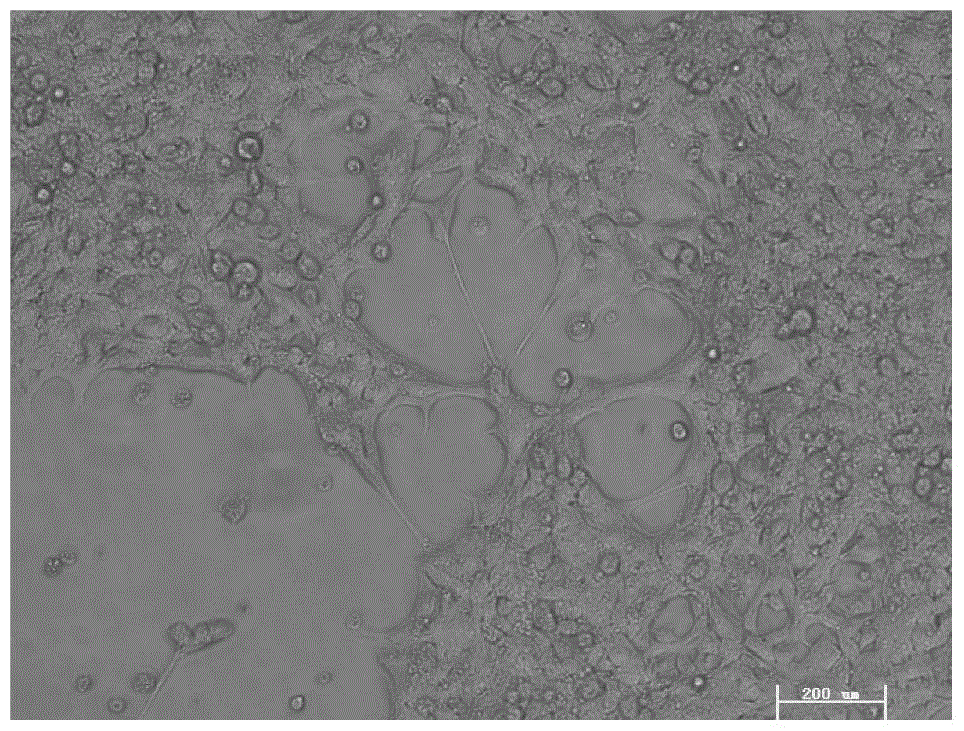 Preparation method and application of immortalized human cartilage endplate stem cell line