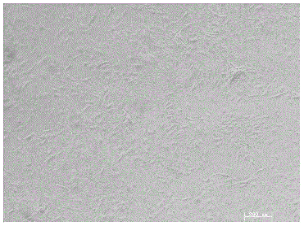 Preparation method and application of immortalized human cartilage endplate stem cell line