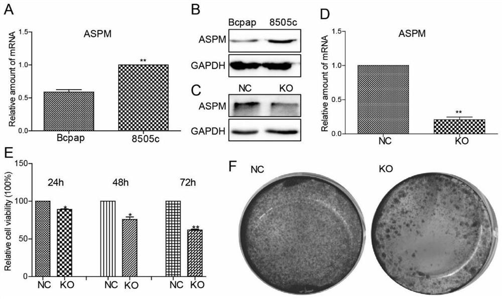 Application of SUZ12 mediating undifferentiated thyroid cancer cell dedifferentiation