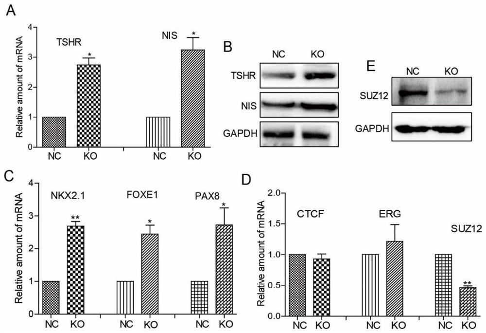 Application of SUZ12 mediating undifferentiated thyroid cancer cell dedifferentiation