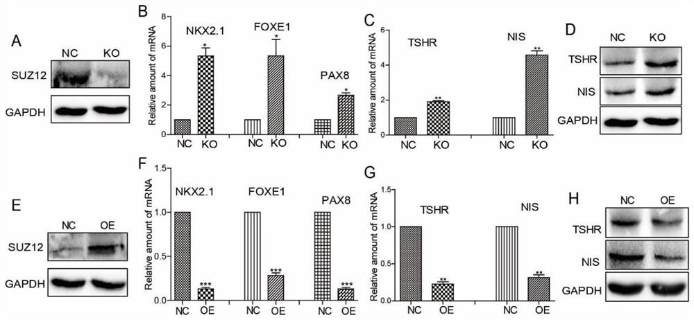 Application of SUZ12 mediating undifferentiated thyroid cancer cell dedifferentiation