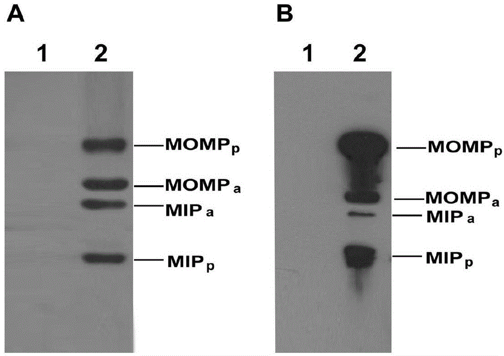 Coexpression vector of Chlamydophila abortus and Chlamydophila psittaci protective antigen MOMP and MIP, construction and expression method thereof