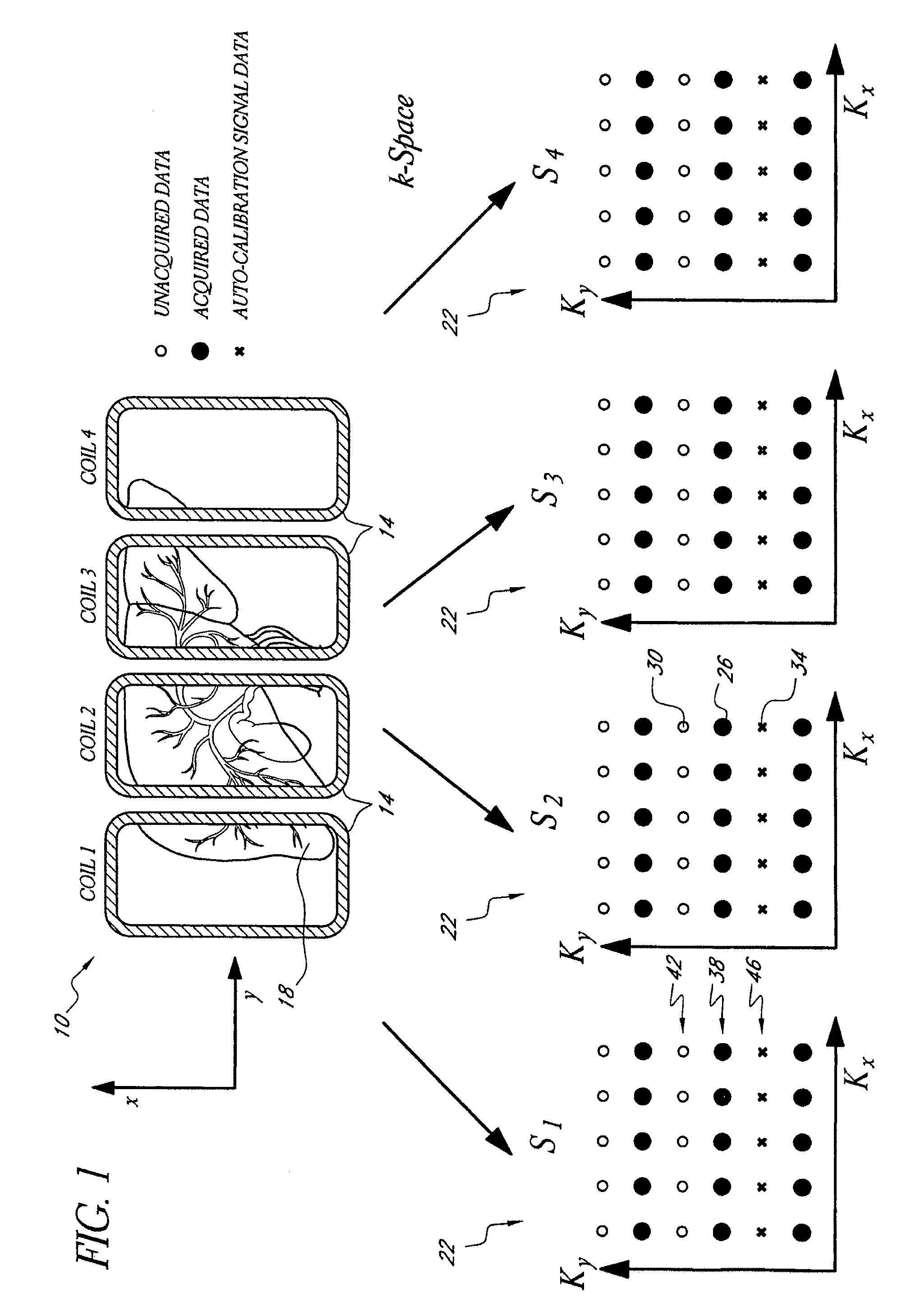 Systems and methods for image reconstruction of sensitivity encoded MRI data