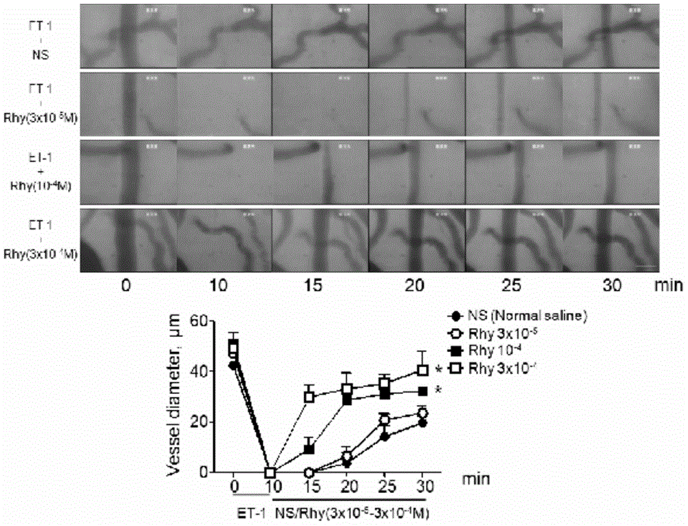 Application of rhynchophylline in preparation of medicine for resisting cerebral vascular contraction