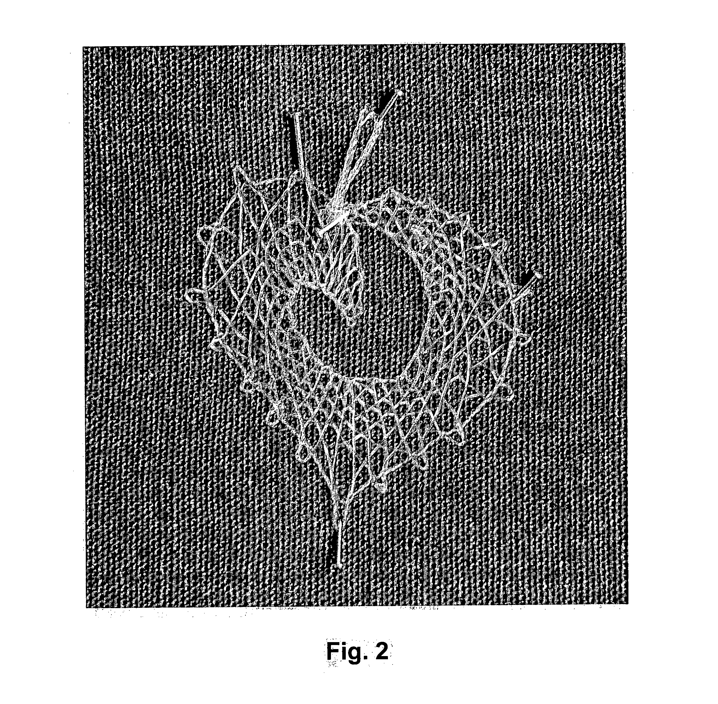 Hyaluronan fibres, method of preparation thereof and use thereof