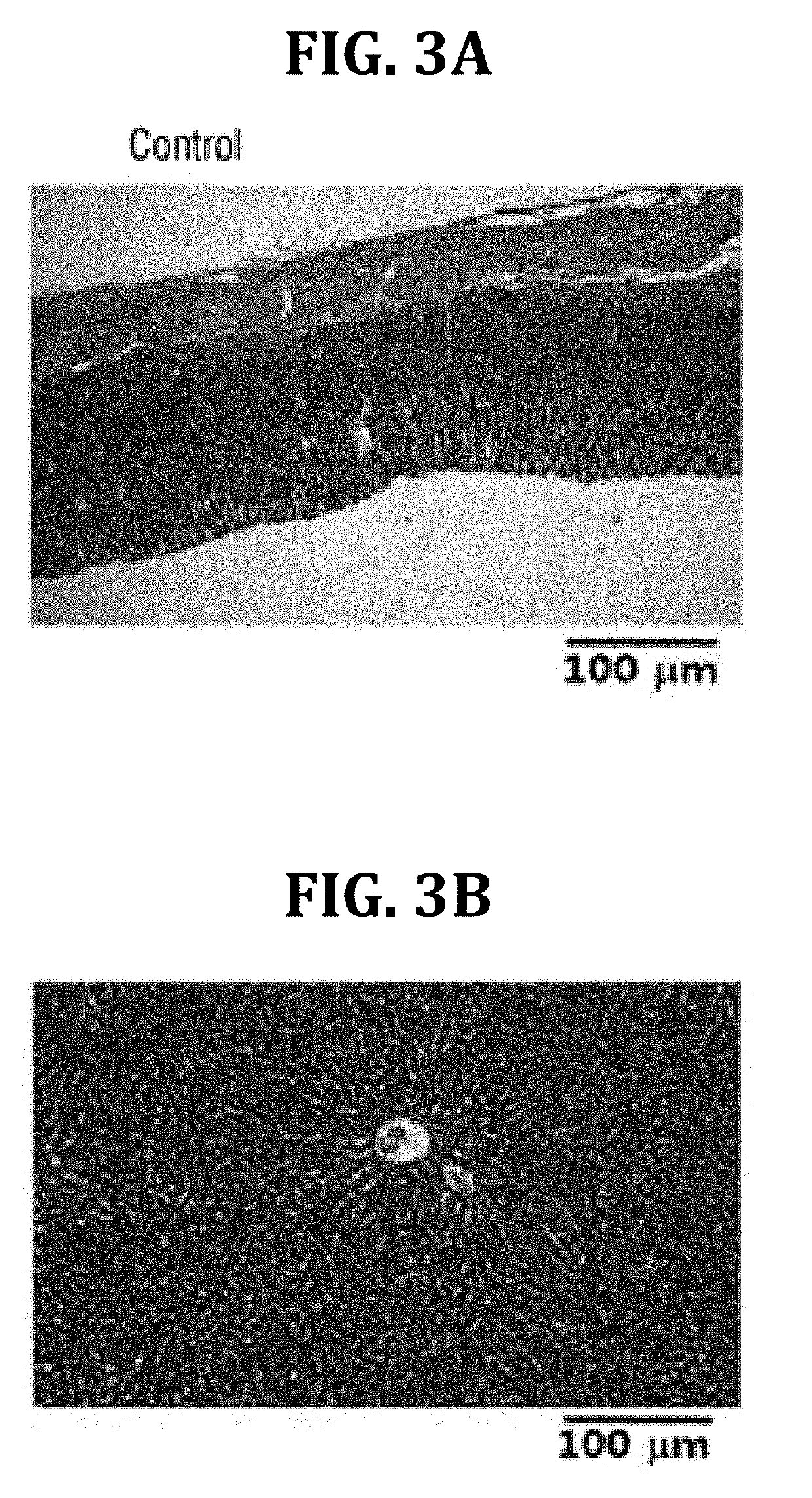 Composition containing dolichos lablab linn. extract as active ingredient for easing hangovers, and preventing, alleviating or treating alcoholic gastrointestinal diseases