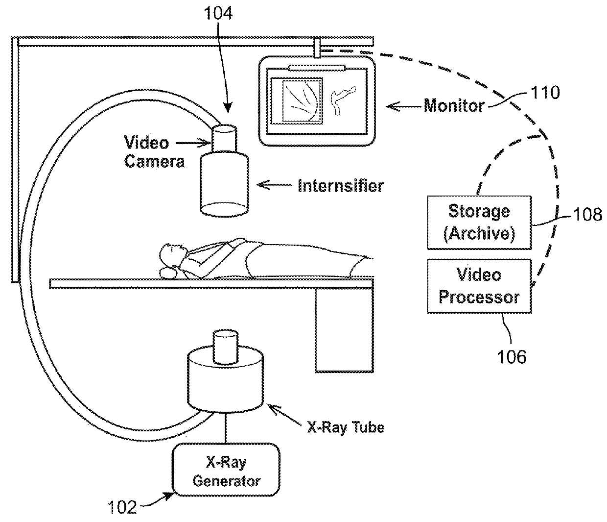 Automated analysis of vasculature in coronary angiograms