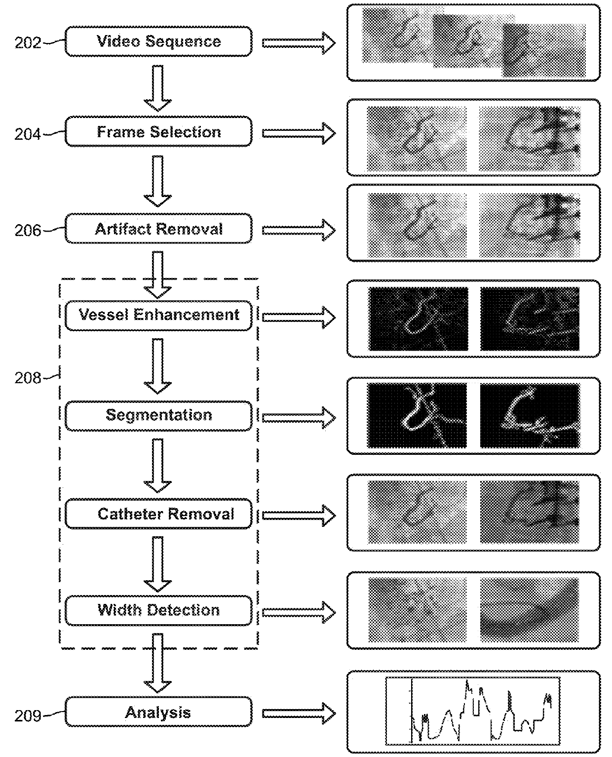 Automated analysis of vasculature in coronary angiograms