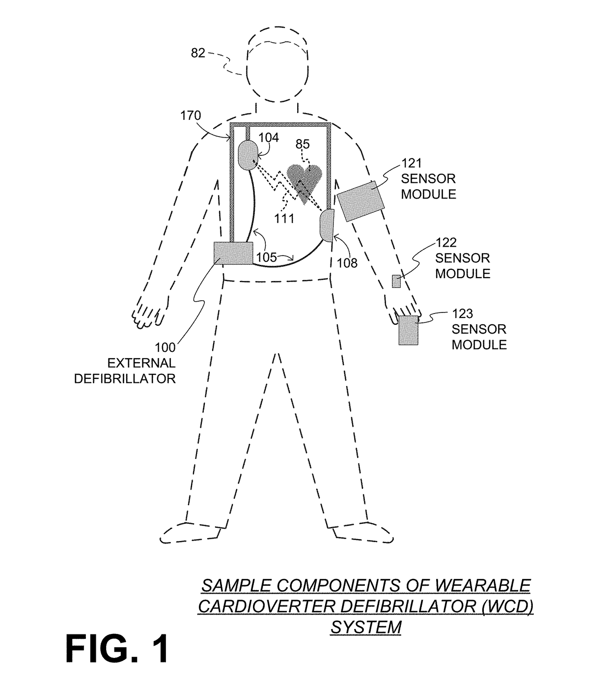 Wearable cardioverter defibrillator (WCD) system using sensor modules with reassurance code for confirmation before shock
