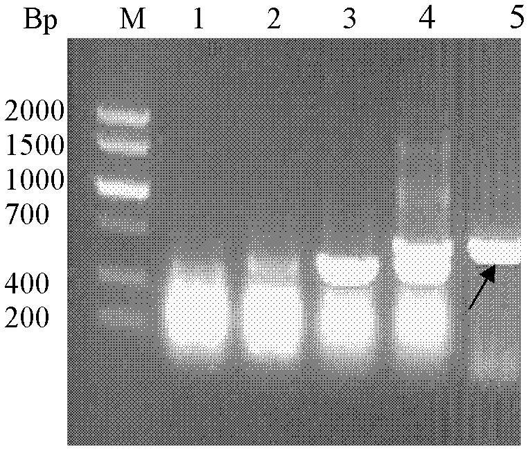 Hybridoma cell strain secreting tetanus exotoxin monoclonal antibody, monoclonal antibody prepared by same, Fab antibody and application