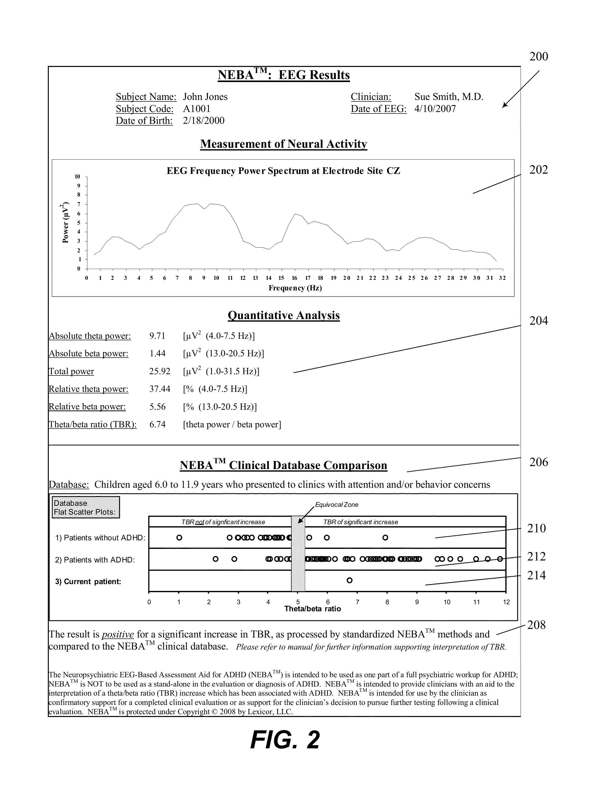 Systems and methods to identify a subgroup of ADHD at higher risk for complicating conditions