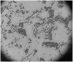 A strain of Lactobacillus plantarum gbw-lp001 with high lactic acid production and its alternative antibacterial agent and application