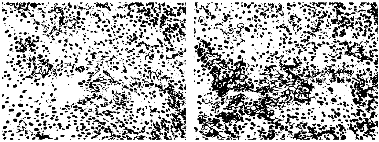 Antibody diluent for enhancing use effect of PD-L1 monoclonal antibody and use method of antibody diluent