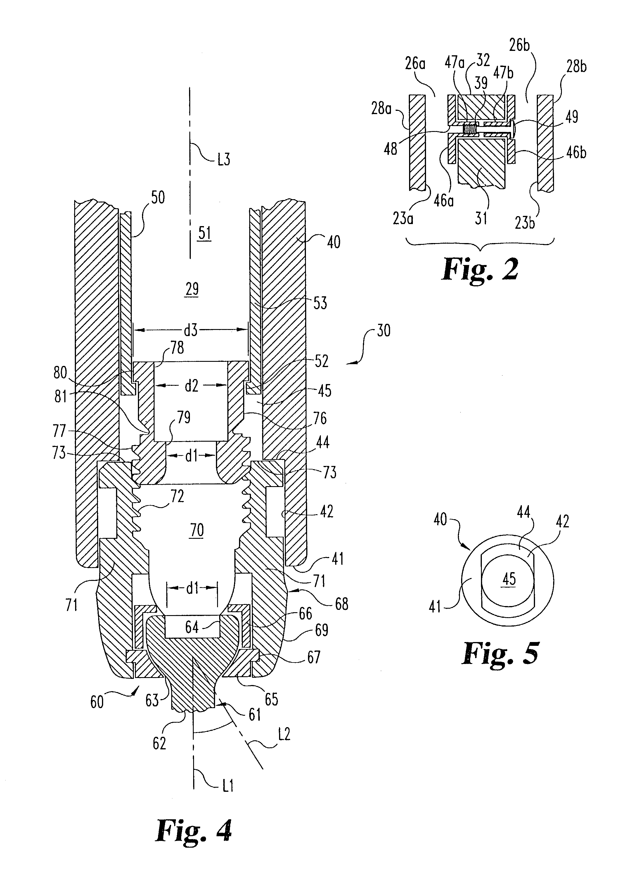 Instruments and methods for stabilization of bony structures