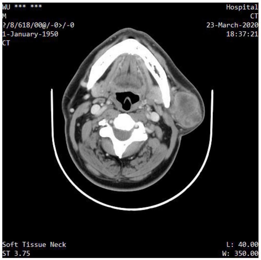 Medical image desensitization and cleaning method based on DICOM