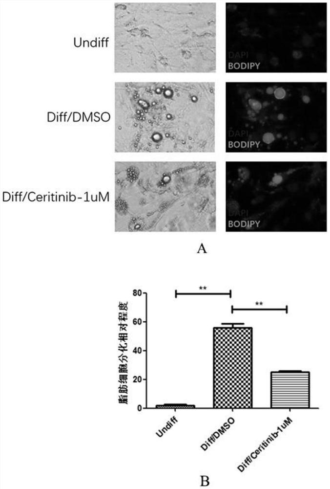 Application of ceritinib in preparation of medicine for treating thyroid-associated ophthalmopathy