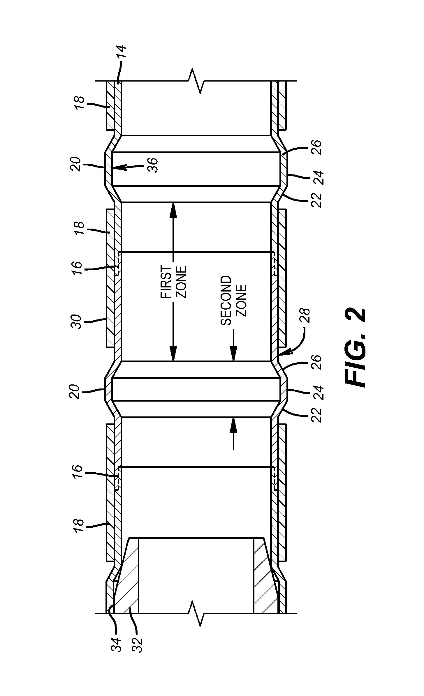 Expandable isolation packer